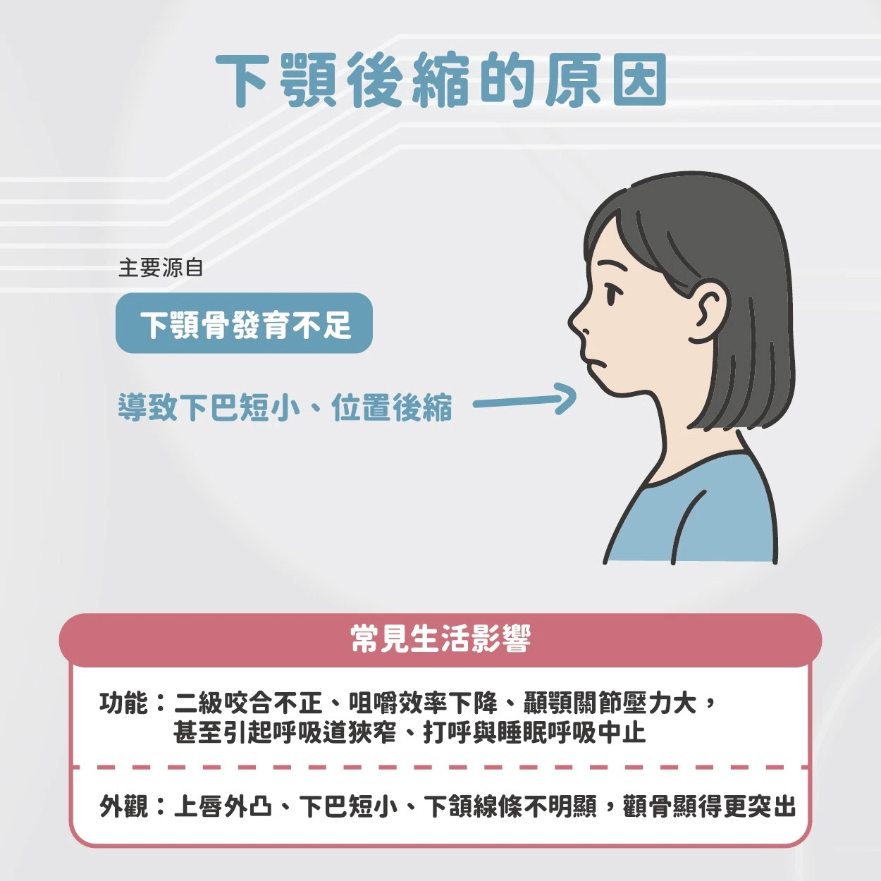 厚道 & 下顎後縮的原因與改善方法 厚道 & 下顎後縮的原因與改善方法