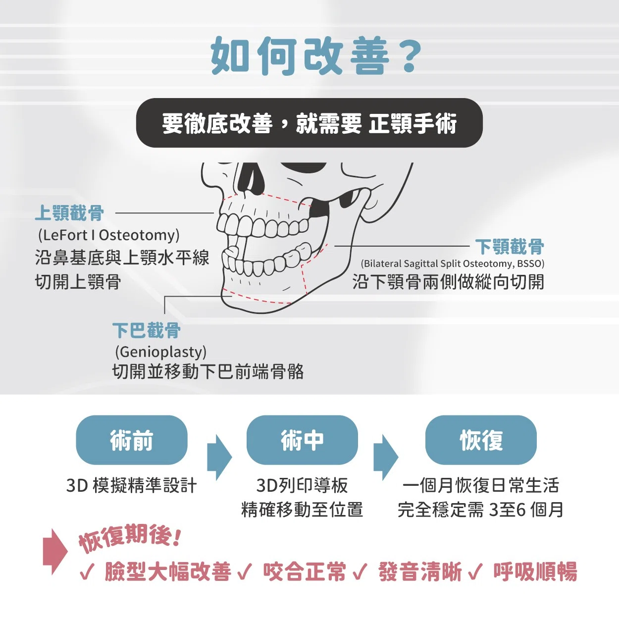 厚道 & 下顎後縮的原因與改善方法 厚道 & 下顎後縮的原因與改善方法